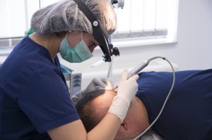 trasplante_de_cabello