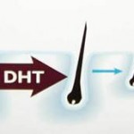 ¿Qué es el DHT?