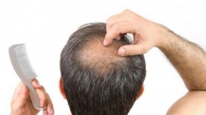 Wanna-beat-the-bald-Shiseido-starts-research-on-hair-regenerative-medicine_strict_xxl
