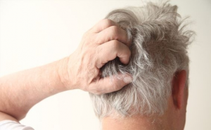 picor_en_el cuero_cabelludo